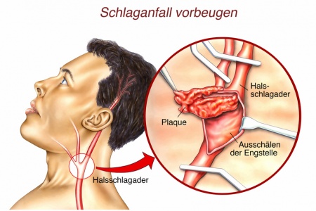 Lesben küssen sich