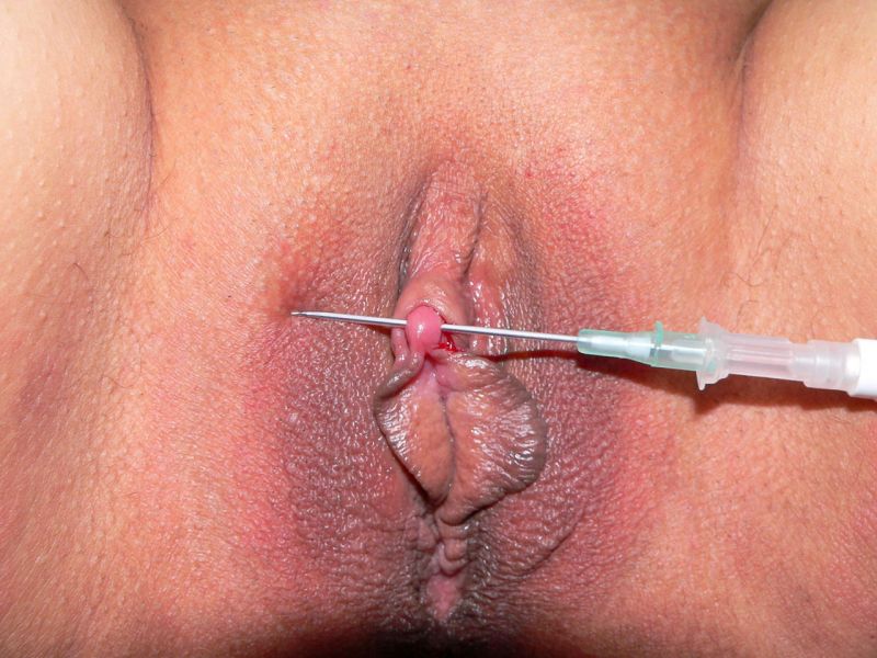 pussy Needle in