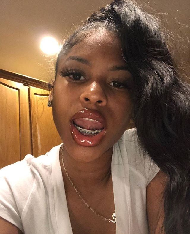 big pussy lips Teen