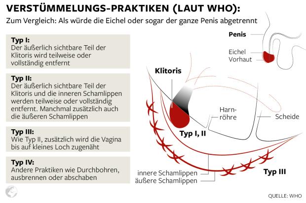 wenn man ist beschnitten masturbiert man Wie