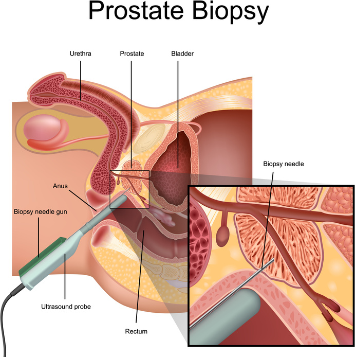 massage abspritzen Prostata