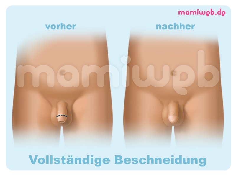 Kostenlose Porno-Bilder Wann nach der geburt wieder sex