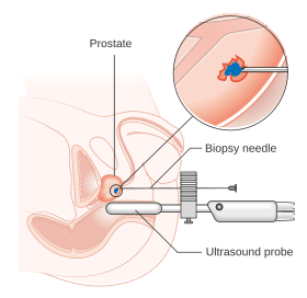 sperma klinik Die