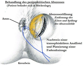 Hilbert recommend Penis passt nicht in scheide