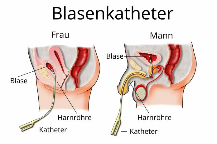 ohne kondom Blasen