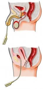 einführen sex Penis