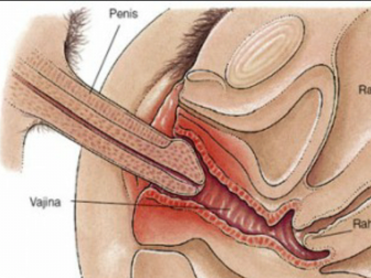 Penis in muschie