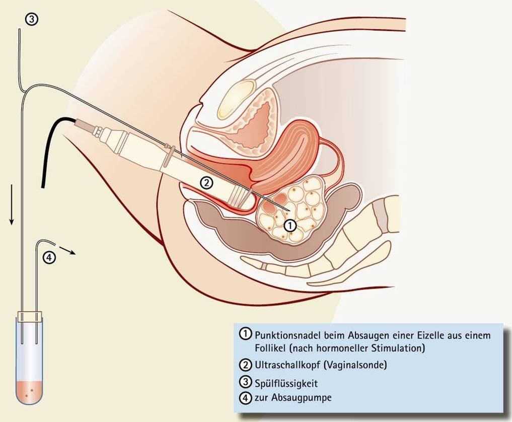 vagina die Sperma in